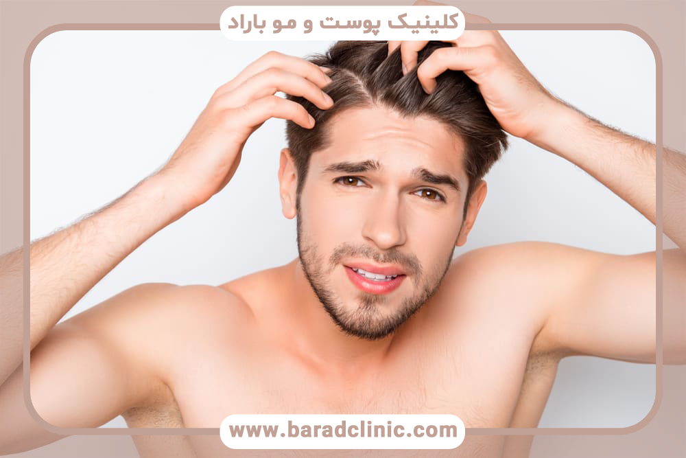 مشکل پوسته سر چیست و چگونه درمان میشود؟