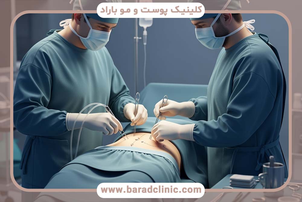 ماندگاری لیفت بدن استاندارد