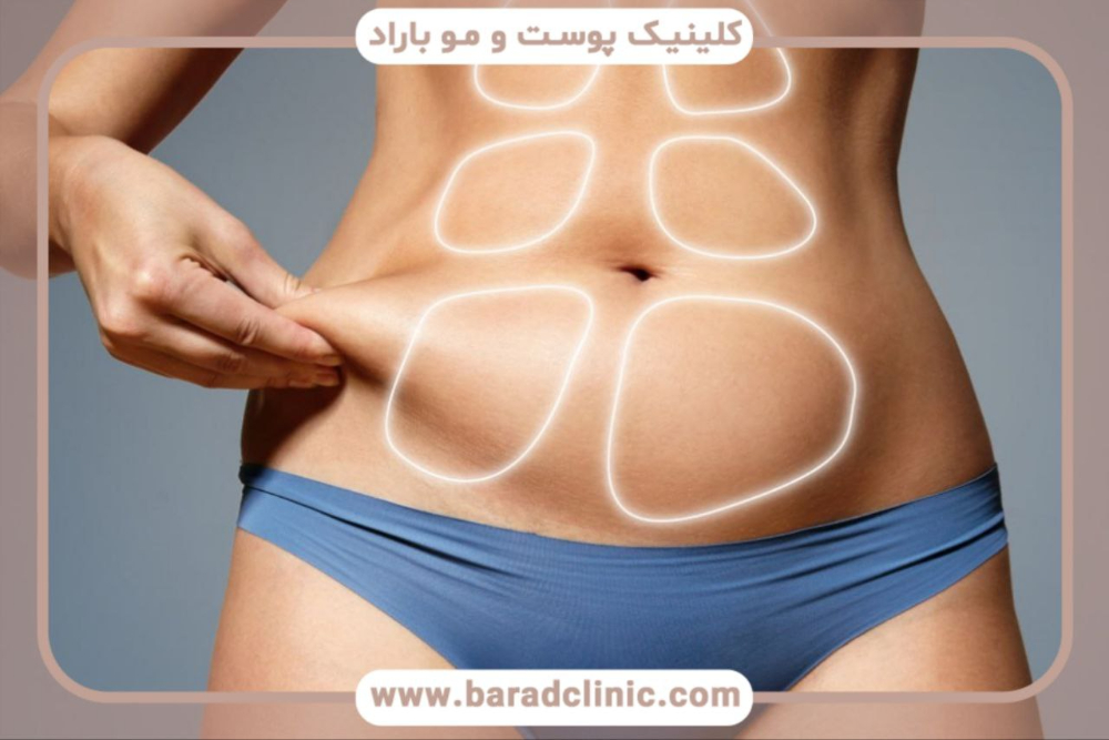 جدیدترین روش‌های پیکرتراشی در ۲۰۲۴