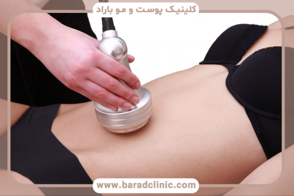 جدیدترین روش‌های پیکرتراشی در ۲۰۲۴