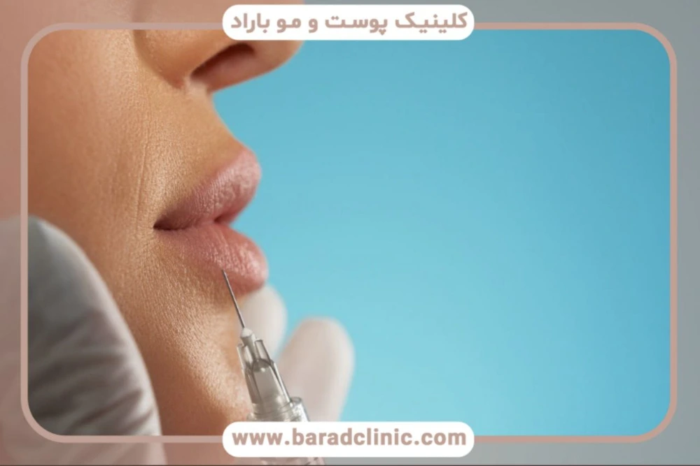
فیلر-چیست-و-چه-کاربردی-دارد