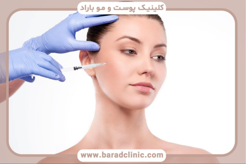 
فیلر-چیست-و-چه-کاربردی-دارد