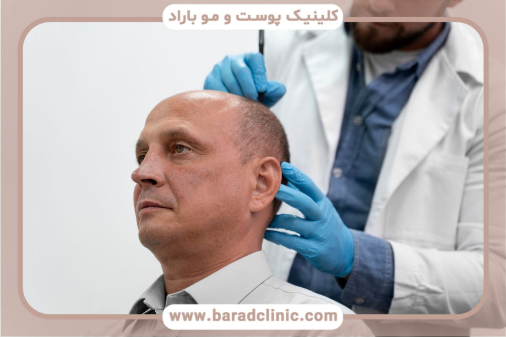 قیمت کاشت مو