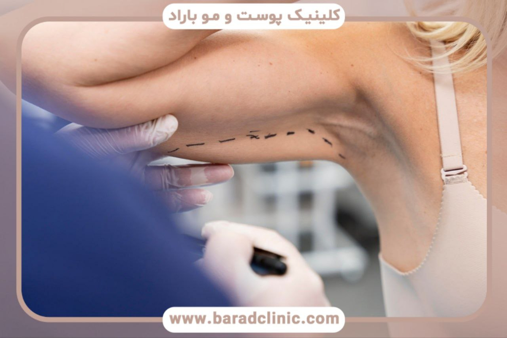 پیکرتراشی اولتراسونیک
