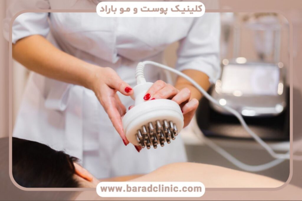 پیکرتراشی با امواج رادیوفرکانسی (RF)