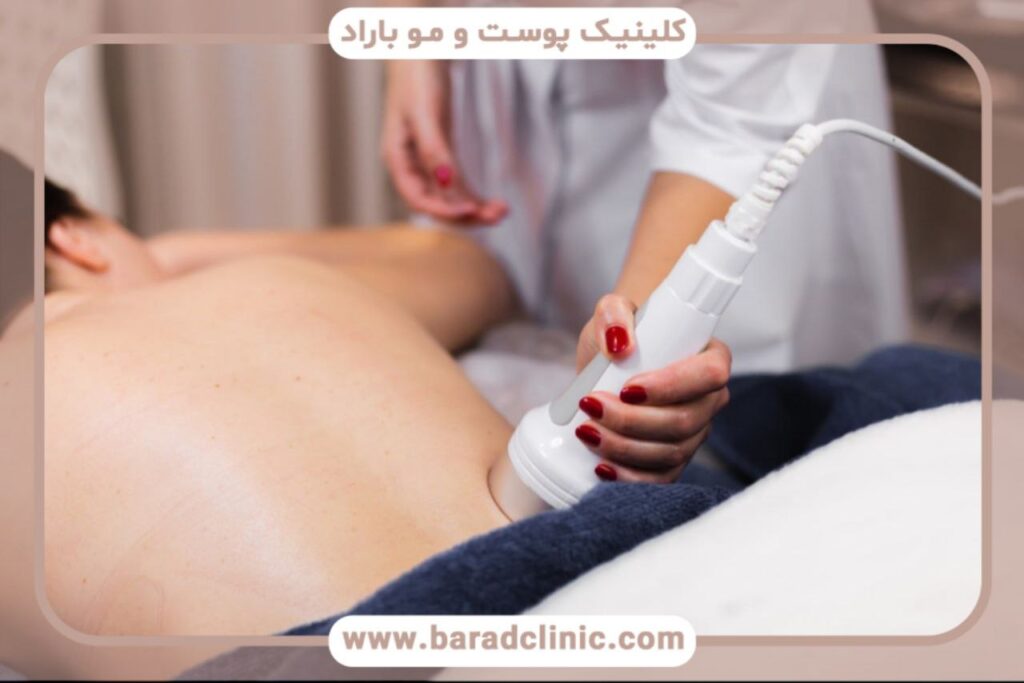 پیکرتراشی با امواج رادیوفرکانسی (RF)