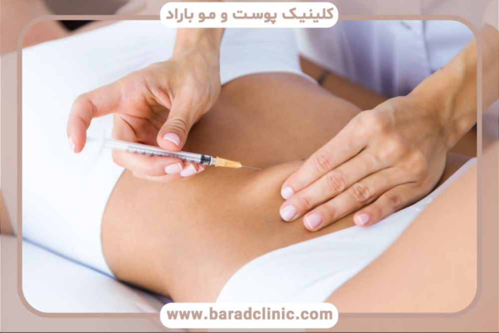  پیکرتراشی ساکشن کم‌تهاجمی