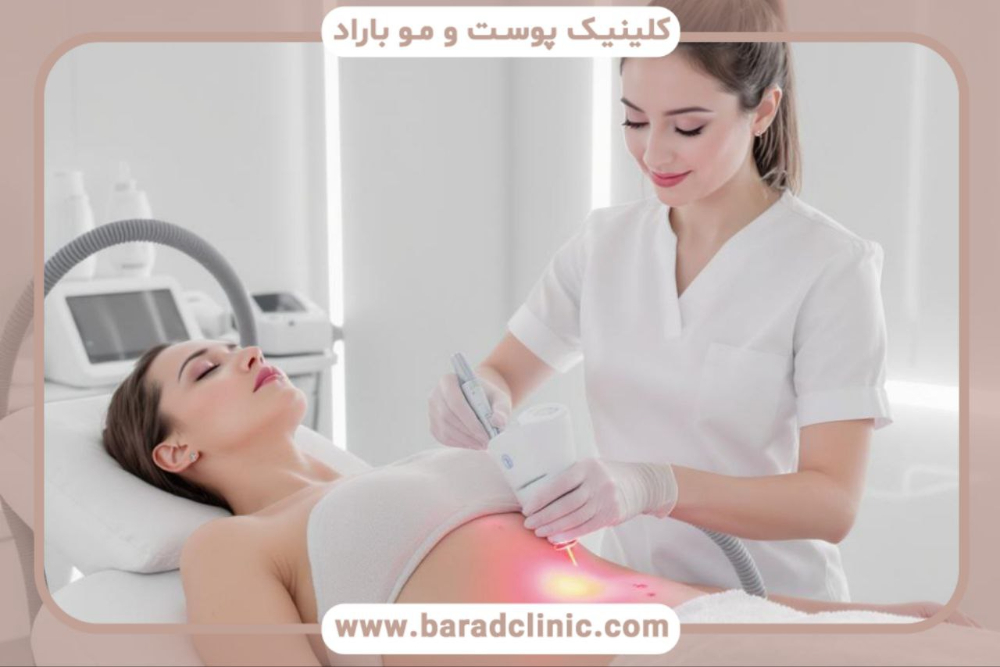 پیکرتراشی لیزری
