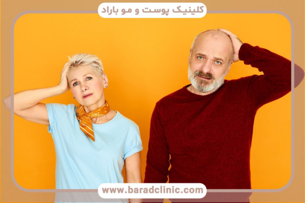 کاشت مو قبل و بعد
