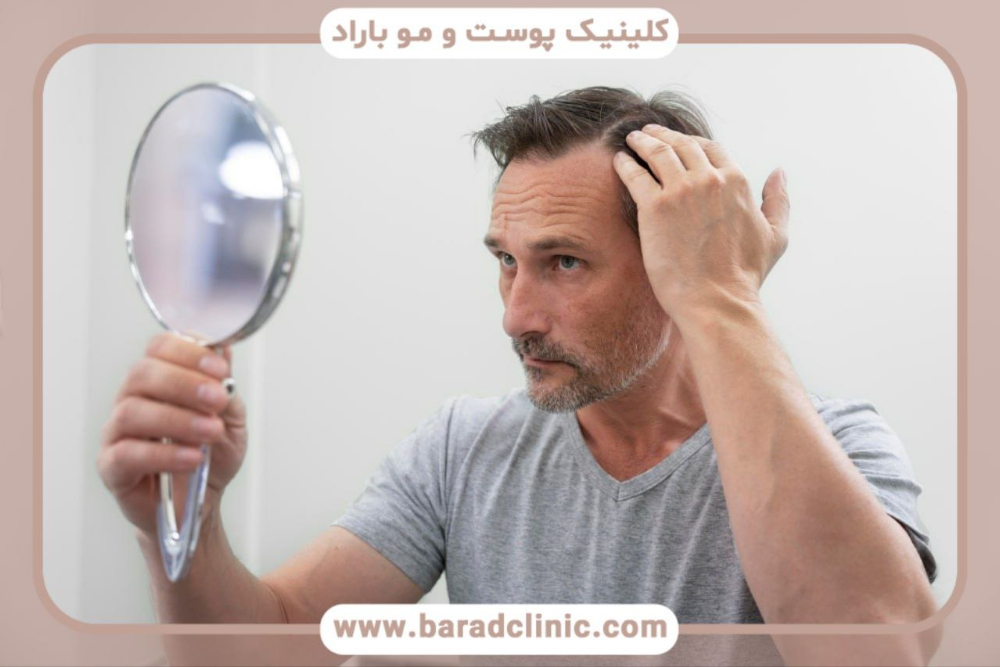 کلینیک کاشت مو