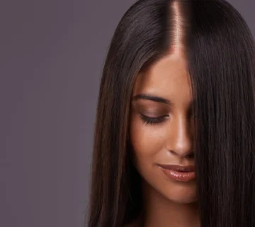 میکروپیگمنتیشن مویرگی