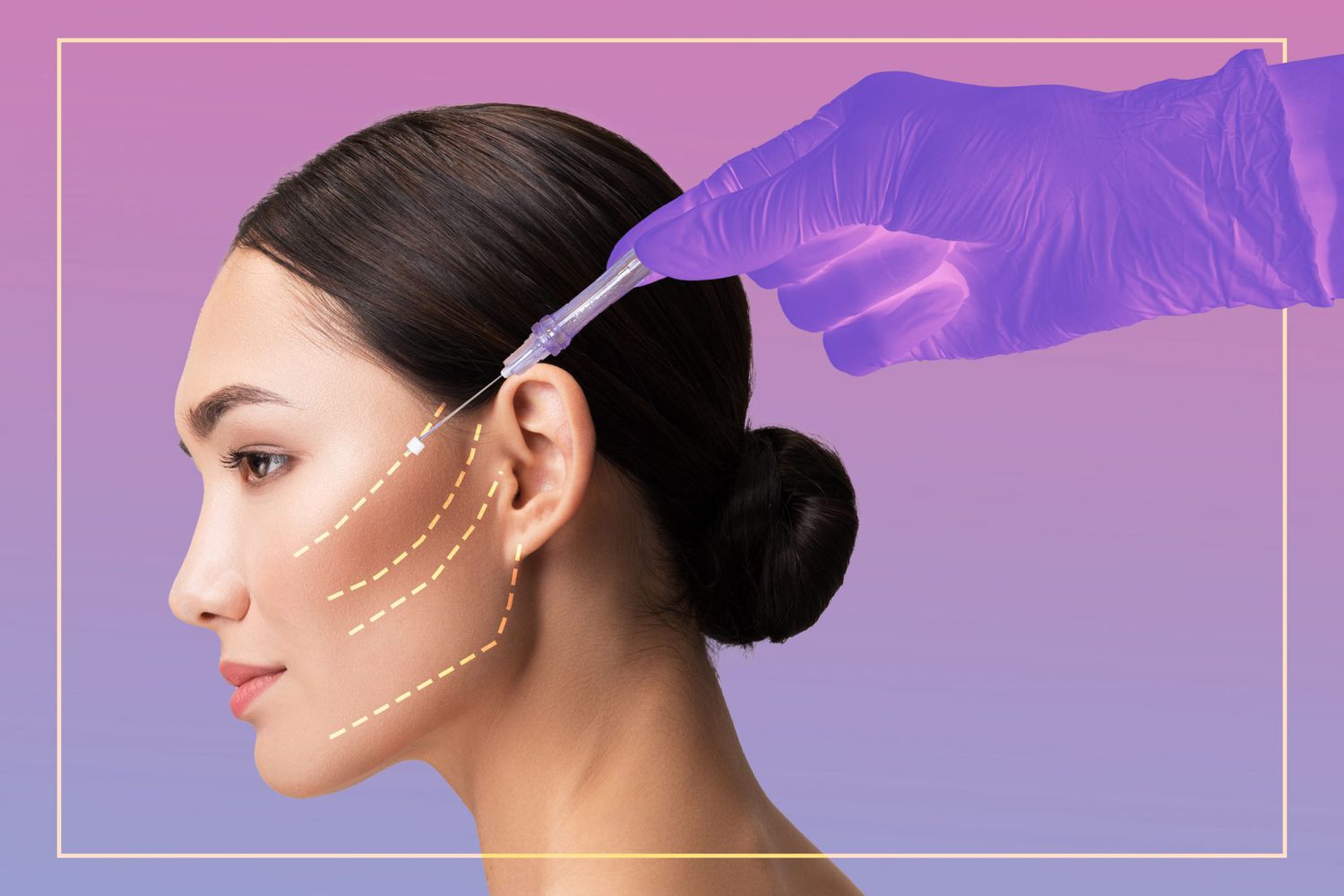 دوران نقاهت و ریکاوری لیفت صورت