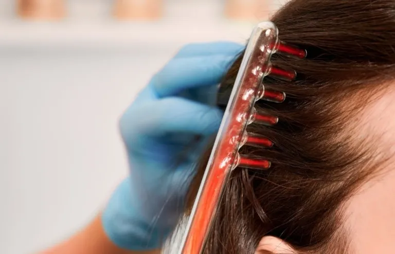 لیزر درمانی برای ریزش