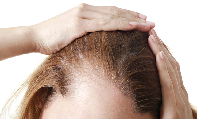 آیا کاشت موی زنان موثر است؟