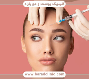 کاربرد بوتاکس