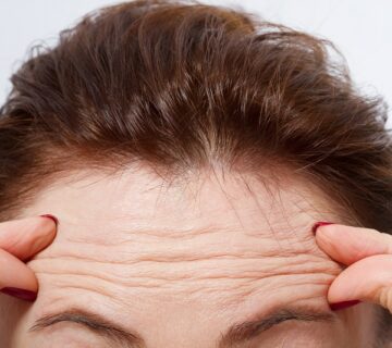 چگونه خطوط عمیق پیشانی را برطرف کنیم