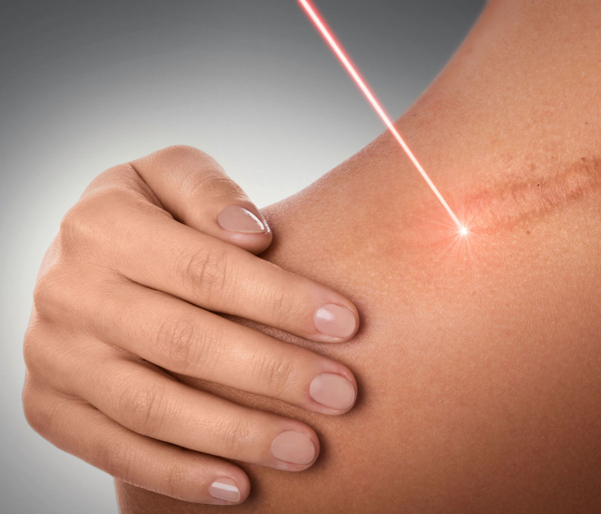 درمان جای زخم