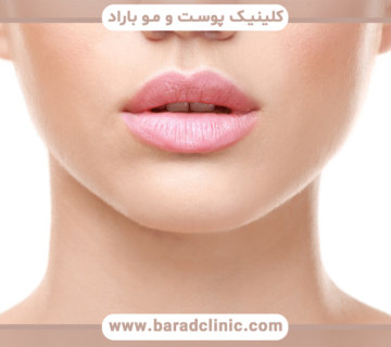 چگونه با تزریق ژل لب های قلبی داشته باشیم