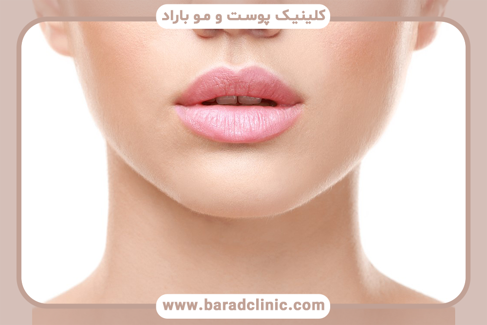 چگونه با تزریق ژل لب های قلبی داشته باشیم