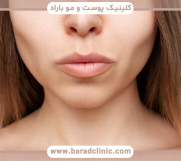 بوکال فت چیست و چرا محبوبیت دارد؟