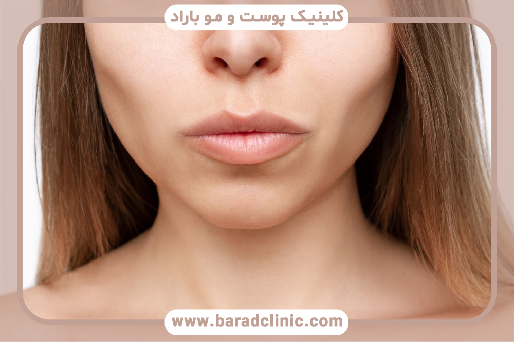 بوکال فت چیست و چرا محبوبیت دارد؟