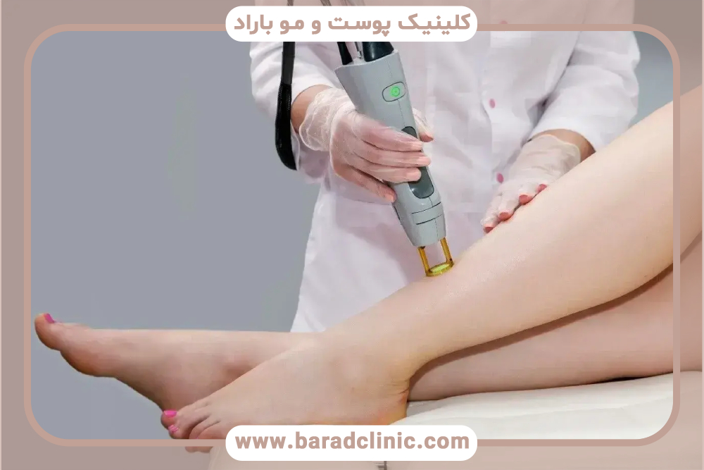 بهبود نتایج لیزر موهای زائد