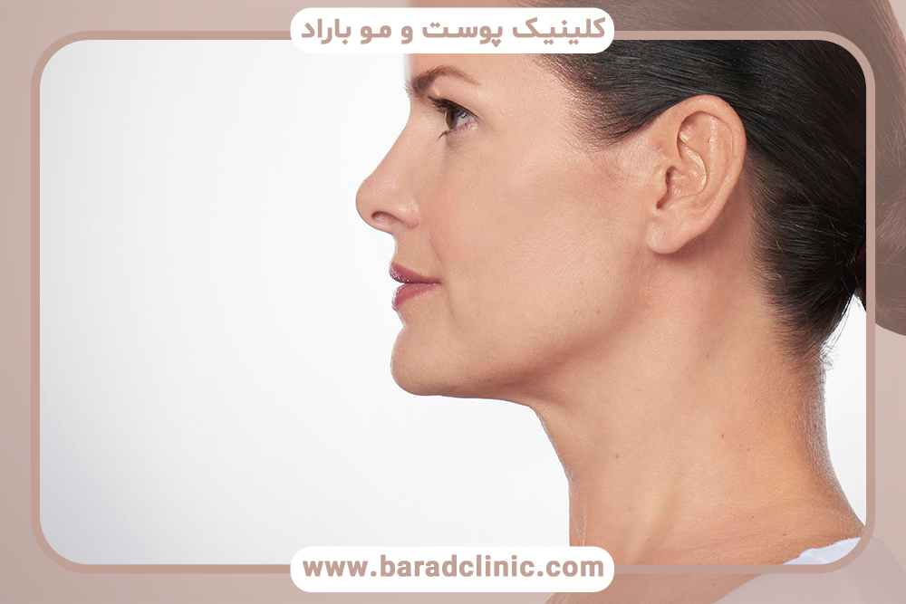 تکنیک‌های جدید در ساکشن غبغب و تأثیرات آن‌ها