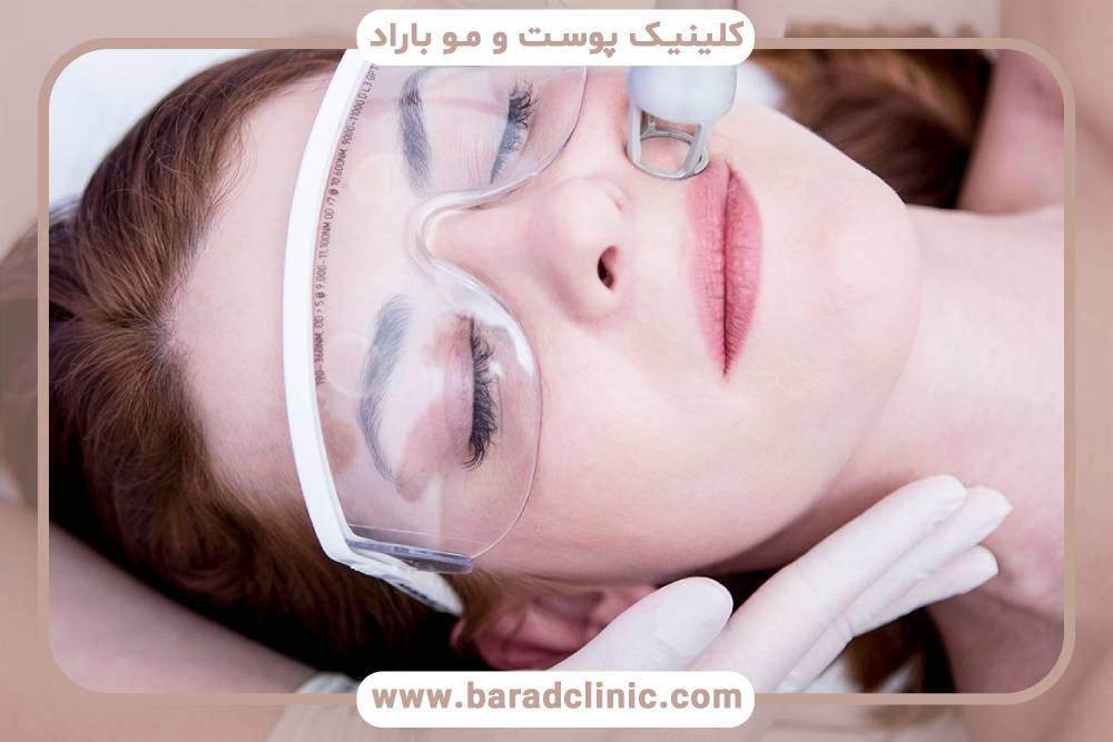 دستگاه لیزر