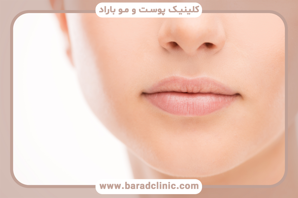 چگونه لب‌های کج را اصلاح کنیم؟ راه‌های اصلاح فرم لب