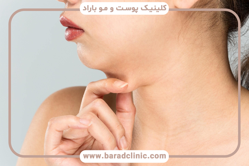 نقش تغذیه و سبک زندگی در بهبودی پس از ساکشن غبغب