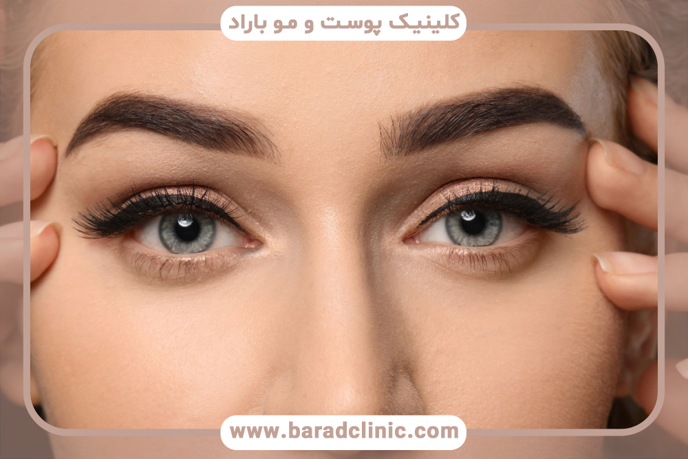 کاشت ابرو و نقش آن در بهبود ظاهر