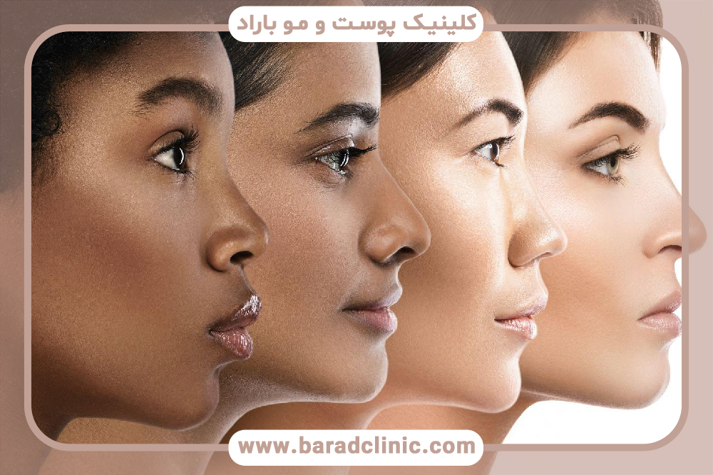 تاثیر انواع مختلف پوست و لیزر موهای زائد