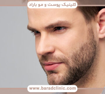 علت کم پشتی موی صورت و کم پشتی ریش آقایان چیست؟