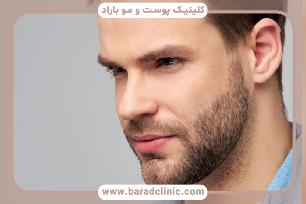 علت کم پشتی موی صورت و کم پشتی ریش آقایان چیست؟