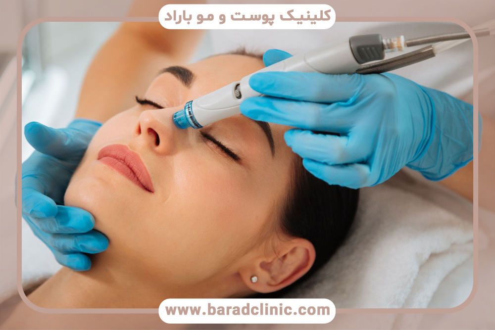 چگونه انتخاب پروسیجر مناسب صورت می‌تواند تاثیرگذار باشد؟