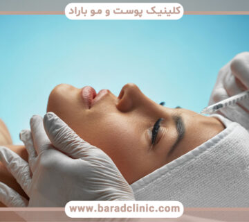 تزریق بوتاکس