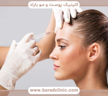 بوتاکس صورت