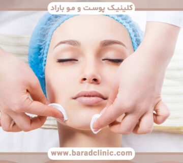 چاق شدن صورت