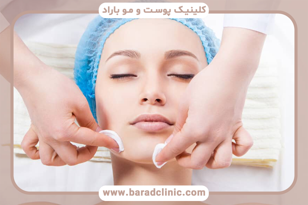 چاق شدن صورت