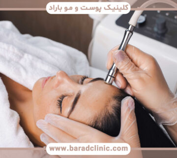 تفاوت میکرودرم ابریژن و لایه برداری شیمیایی