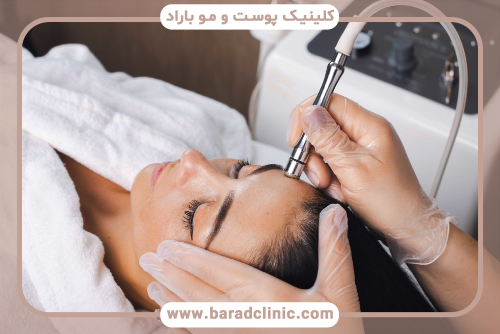تفاوت میکرودرم ابریژن و لایه برداری شیمیایی
