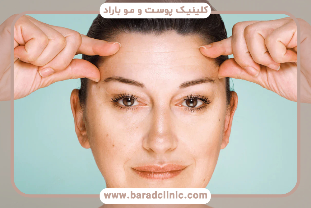 چین و چروک‌های عمیق