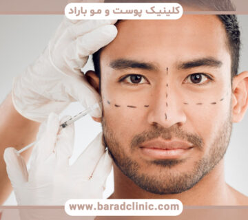 اثر پیشگیرانه بوتاکس