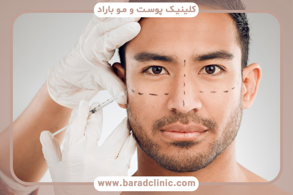 اثر پیشگیرانه بوتاکس