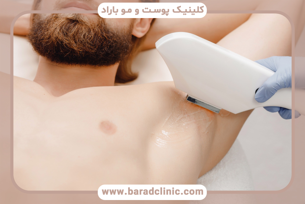 جلسات لیزر موی زائد