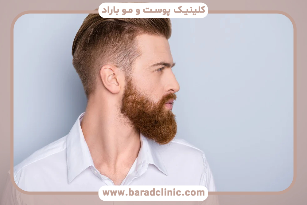 تغییر رنگ مو و ریش