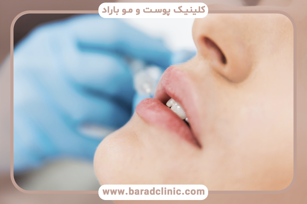 روش‌های رفع افتادگی گوشه لب‌ها چیست؟