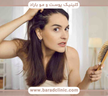 ریزش مو یکی از اصلیترین عوارض راکوتان