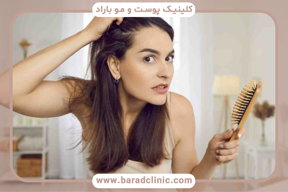 ریزش مو یکی از اصلی‌ترین عوارض راکوتان