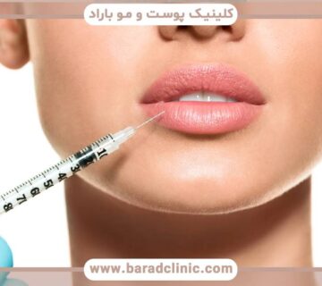انتخاب روش مناسب برای تزریق فیلر لب انتخاب روش مناسب برای تزریق فیلر لب